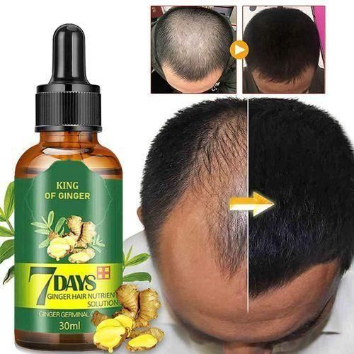 Aichun Beauty King Of Ginger 7 Days Hair Tonic ,hair Growth Oil