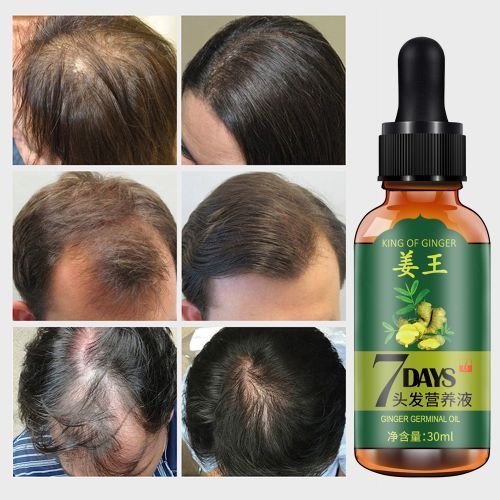 Aichun Beauty 7 Days King Of Ginger Germinal Hair.