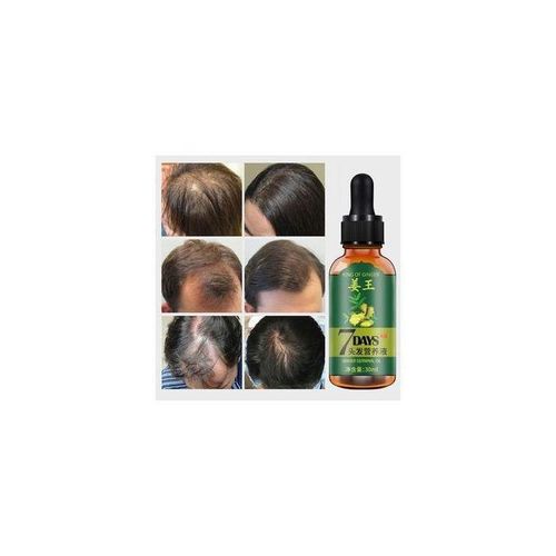7 Day Germinal Essential Hair Growth Oil For Hair Treatment-For Both Men&Women30ml