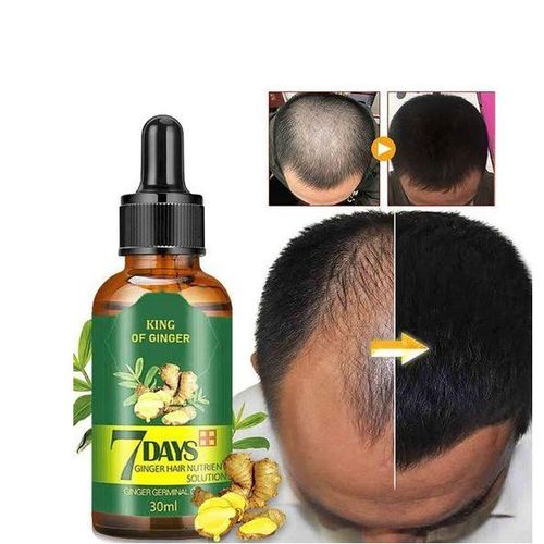7 Day Hair Tonic,hair Growth, Anti-hair Loss Oil