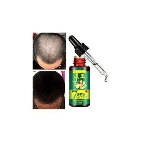 Aichun Beauty 7 Days Hair Tonic Ginger Germinal Regrowth Oil