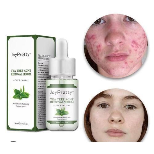 Tea Tree JoyPretty acne removal serum 30ml