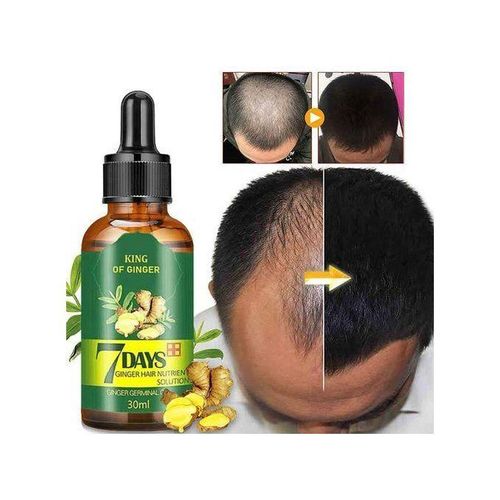 7 Day Hair Tonic,hair Growth, Anti-hair Loss Prime Oil