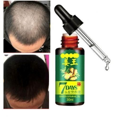 Aichun Beauty 7Days Gluta Magic Ginger Germinal Hair Oil Growth Essence-30ml